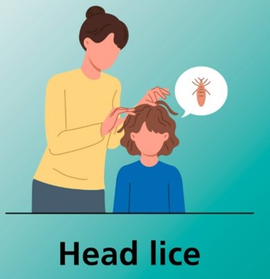 HEADLICE
